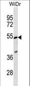 Phosphatidylinositol Glycan Anchor Biosynthesis Class V antibody, LS-C163720, Lifespan Biosciences, Western Blot image 