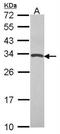 TIMP Metallopeptidase Inhibitor 4 antibody, NBP2-20645, Novus Biologicals, Western Blot image 