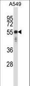 Keratin, type II cytoskeletal 6C antibody, LS-C165633, Lifespan Biosciences, Western Blot image 