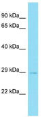 Family With Sequence Similarity 156 Member B antibody, TA335916, Origene, Western Blot image 