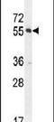 CTD Small Phosphatase Like 2 antibody, PA5-24421, Invitrogen Antibodies, Western Blot image 