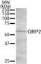 Oxysterol Binding Protein Like 2 antibody, NB100-1332, Novus Biologicals, Western Blot image 