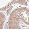 Ring Finger Protein 167 antibody, HPA049810, Atlas Antibodies, Immunohistochemistry frozen image 