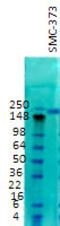 Sodium Voltage-Gated Channel Alpha Subunit 2 antibody, TA326577, Origene, Western Blot image 