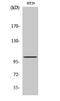 G Protein Regulated Inducer Of Neurite Outgrowth 1 antibody, STJ93424, St John