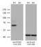 Proprotein Convertase Subtilisin/Kexin Type 9 antibody, LS-C796131, Lifespan Biosciences, Western Blot image 