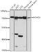 Beta,beta-carotene 15,15 -monooxygenase antibody, A07016, Boster Biological Technology, Western Blot image 