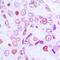 Cyclin G1 antibody, orb213680, Biorbyt, Immunohistochemistry paraffin image 