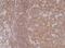 Nuclear Factor Kappa B Subunit 1 antibody, NBP2-61568, Novus Biologicals, Immunohistochemistry paraffin image 
