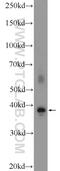 Forkhead Box R1 antibody, 21942-1-AP, Proteintech Group, Western Blot image 