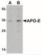Apolipoprotein E antibody, NBP2-41216, Novus Biologicals, Western Blot image 