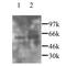 C-X3-C Motif Chemokine Ligand 1 antibody, GTX45091, GeneTex, Western Blot image 