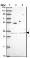 SH2B Adaptor Protein 2 antibody, NBP2-13305, Novus Biologicals, Western Blot image 