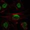 Sirtuin 1 antibody, GTX82793, GeneTex, Immunofluorescence image 