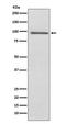 Prospero Homeobox 1 antibody, M01985-1, Boster Biological Technology, Western Blot image 