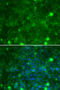 TIMP Metallopeptidase Inhibitor 3 antibody, STJ25854, St John