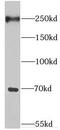 Eukaryotic Translation Initiation Factor 4 Gamma 3 antibody, FNab02725, FineTest, Western Blot image 