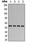 Aldehyde Dehydrogenase 1 Family Member A1 antibody, LS-C354529, Lifespan Biosciences, Western Blot image 