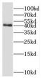 Protein Phosphatase, Mg2+/Mn2+ Dependent 1A antibody, FNab06684, FineTest, Western Blot image 