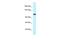 Protein MCM10 homolog antibody, PA5-68751, Invitrogen Antibodies, Western Blot image 