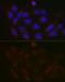 Polypeptide N-Acetylgalactosaminyltransferase 3 antibody, GTX66226, GeneTex, Immunocytochemistry image 