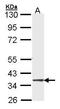 Meiotic recombination protein DMC1/LIM15 homolog antibody, TA308368, Origene, Western Blot image 