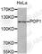 Ribonucleases P/MRP protein subunit POP1 antibody, A5961, ABclonal Technology, Western Blot image 