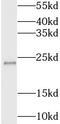 BLOC-1 Related Complex Subunit 5 antibody, FNab04819, FineTest, Western Blot image 