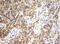 ADP Ribosylation Factor Like GTPase 2 Binding Protein antibody, LS-C797854, Lifespan Biosciences, Immunohistochemistry paraffin image 