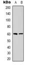 Nuclear Receptor Binding Protein 1 antibody, LS-C368777, Lifespan Biosciences, Western Blot image 