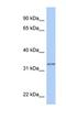 Glutathione S-Transferase Omega 2 antibody, NBP1-54580, Novus Biologicals, Western Blot image 