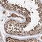 Inositol Polyphosphate-4-Phosphatase Type II B antibody, HPA037681, Atlas Antibodies, Immunohistochemistry frozen image 