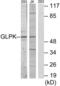 Glycerol Kinase antibody, LS-B9143, Lifespan Biosciences, Western Blot image 