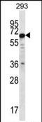 Phosphatase And Actin Regulator 3 antibody, PA5-71757, Invitrogen Antibodies, Western Blot image 