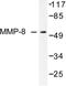 Matrix Metallopeptidase 8 antibody, LS-C176131, Lifespan Biosciences, Western Blot image 