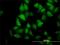 Biogenesis Of Lysosomal Organelles Complex 1 Subunit 4 antibody, H00055330-M02, Novus Biologicals, Immunofluorescence image 