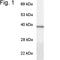 G Protein Subunit Alpha Transducin 1 antibody, NB120-3504, Novus Biologicals, Western Blot image 