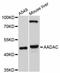 Arylacetamide deacetylase antibody, A10365, ABclonal Technology, Western Blot image 