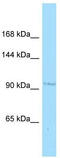 Cysteine Rich Transmembrane BMP Regulator 1 antibody, TA338048, Origene, Western Blot image 