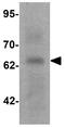 G Protein-Coupled Receptor Kinase 6 antibody, GTX31564, GeneTex, Western Blot image 