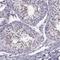 H1 Histone Family Member O Oocyte Specific antibody, NBP1-86265, Novus Biologicals, Immunohistochemistry paraffin image 