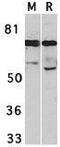 Interleukin 1 Receptor Associated Kinase 3 antibody, GTX31265, GeneTex, Western Blot image 