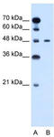 PBX Homeobox 1 antibody, TA329195, Origene, Western Blot image 
