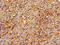 Annexin A2 antibody, LS-C369235, Lifespan Biosciences, Immunohistochemistry paraffin image 