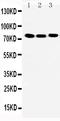 TGF-Beta Activated Kinase 1 (MAP3K7) Binding Protein 2 antibody, PA2289, Boster Biological Technology, Western Blot image 