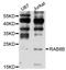 RAB8B, Member RAS Oncogene Family antibody, LS-C332711, Lifespan Biosciences, Western Blot image 