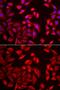 Chaperonin Containing TCP1 Subunit 2 antibody, GTX33535, GeneTex, Immunocytochemistry image 