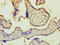 Zinc Finger RANBP2-Type Containing 2 antibody, LS-C317723, Lifespan Biosciences, Immunohistochemistry paraffin image 