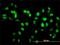 Sirtuin 1 antibody, H00023411-M01, Novus Biologicals, Immunocytochemistry image 