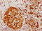 Heterogeneous Nuclear Ribonucleoprotein K antibody, CSB-RA010611A0HU, Cusabio, Immunohistochemistry paraffin image 
